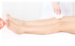 消化性溃疡拔罐