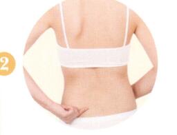 腰椎间盘突出拔罐