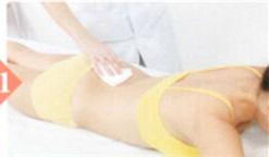 腰椎间盘突出拔罐