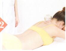 急性扁桃体炎拔罐