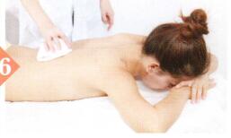 梅尼埃综合征拔罐