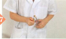 梅尼埃综合征拔罐