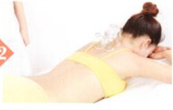 神经性皮炎拔罐