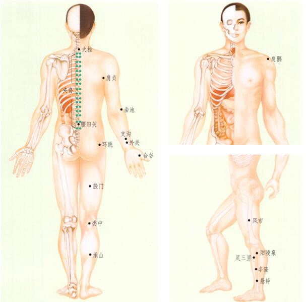 中风后遗症刮痧