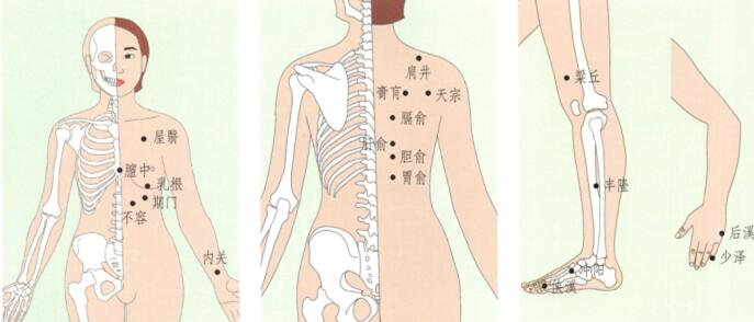 急性乳腺炎刮痧