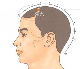 承光穴