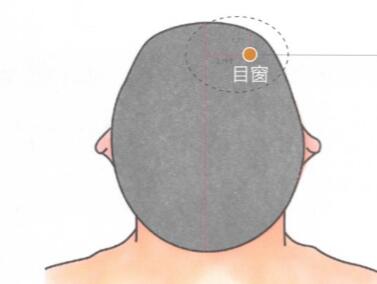 目窗穴