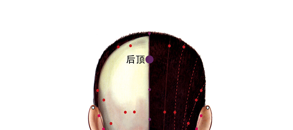 后顶穴